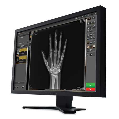 Software für medizinische Bildgebung - Image Suite V4 - Carestream - Analyse / Management / Visualisierung