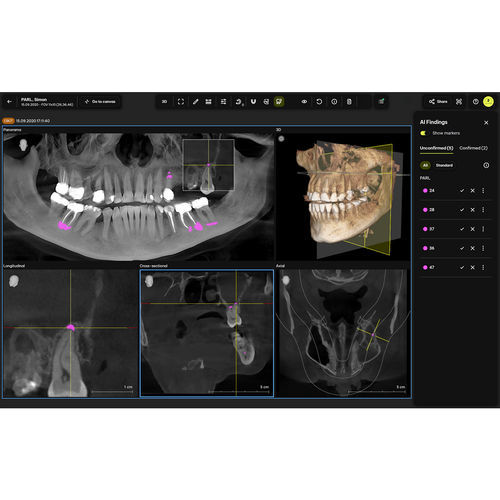 Diagnose-Software - Smart View – Detect - Dentsply Sirona - Hilfs / Röntgen / Zahn