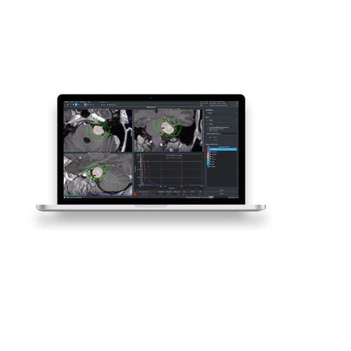 Software für Kliniken - Leksell GammaPlan® - Elekta - Computertomographie / für DICOM / TEP