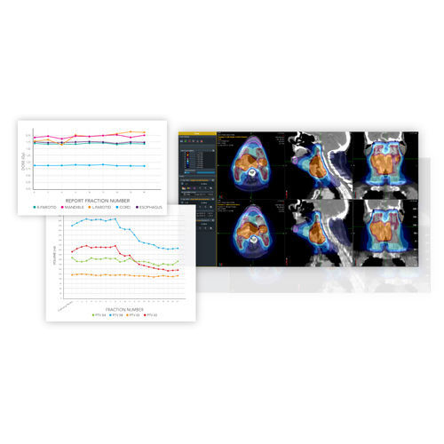 Software für Radiologie - PreciseART® - Accuray - Datenanalyse / Reporting / Planung