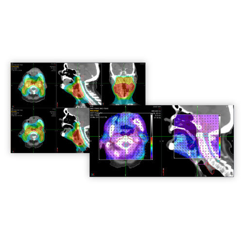 Computertomographie-Software - PreciseRTX® - Accuray - Steuerung der Energiedosis / Behandlungsplanung / für Tablet-PC