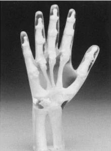 Testphantom für Röntgenzwecke - Capintec - Hand