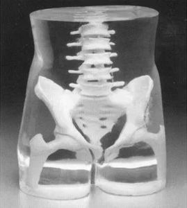 Testphantom für Röntgenzwecke - Capintec - Abdomen