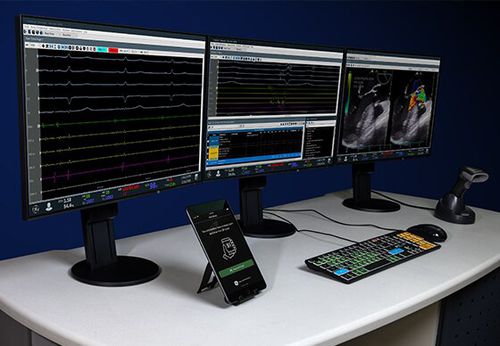 Visualisierungssoftware - Mac-Lab  ™ - GE Healthcare - Aufzeichnung / Interoperabilität / Datenaustausch