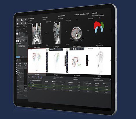 Android-Applikation / Kommunikation - Xeleris V - GE Healthcare - Mess / Analyse / für Nuklearmedizin