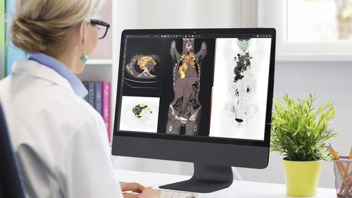 Umform-Software - MIM™ - GE Healthcare - Planung / Behandlungsplanung / medizinisch