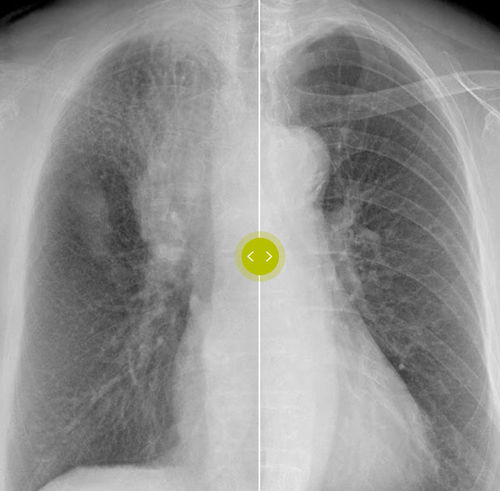 Medizinische Software - Philips Healthcare - Röntgen / zur Bildverbesserung / Knochen