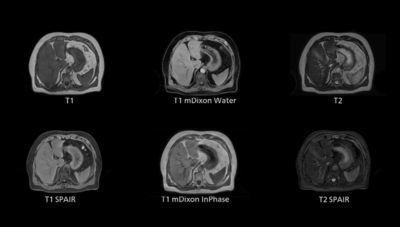 Simulationssoftware - 4D MR-RT - Philips Healthcare - Konturierung / Behandlungsplanung / medizinisch