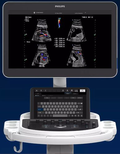 Ultraschallgerät / tragbar, mit Transportwagen - Elevate Plus - Philips Healthcare - für Multifunktions-Ultraschall / Schwarz-Weiß / mit Touchscreen