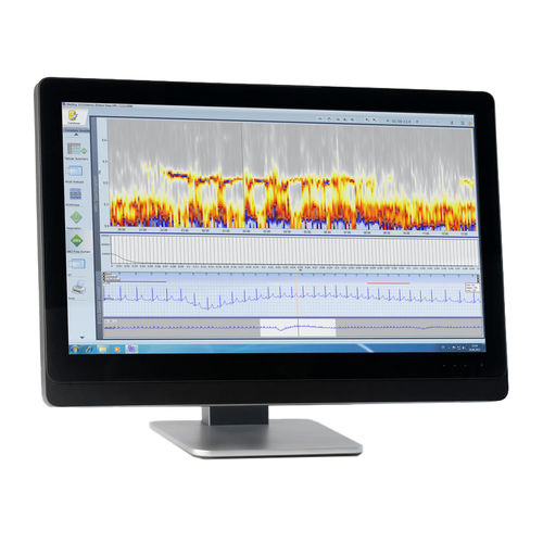 Analysesoftware - SCHILLER