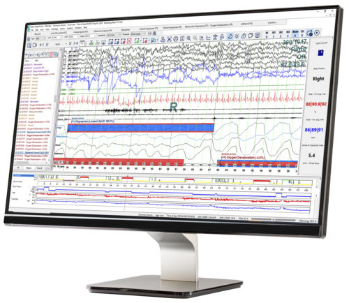 Analysesoftware - SleepWorks™ - Natus Hearing & Balance - Management / Reporting / Diagnose