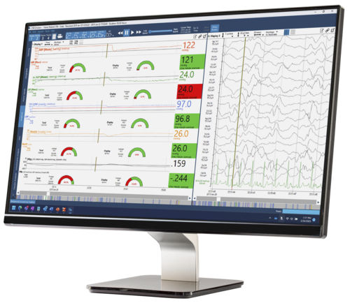 Analysesoftware - Moberg CNS - Natus Hearing & Balance - Management / Monitoring / Umform