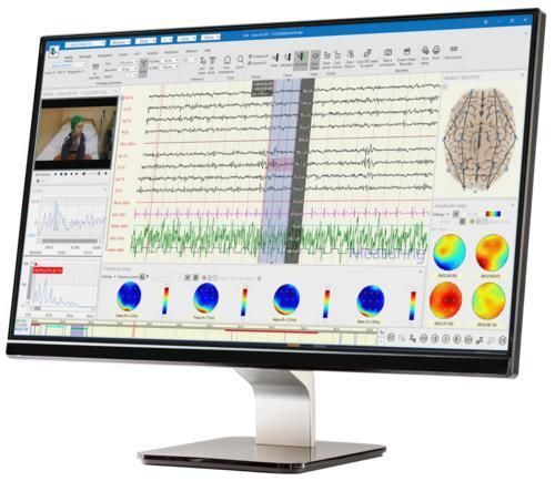 Verwaltungs- und Analysesystem / Visualisierung - BRAIN QUICK® - Natus Hearing & Balance - für DCIM-Datei / Diagnose / Signal