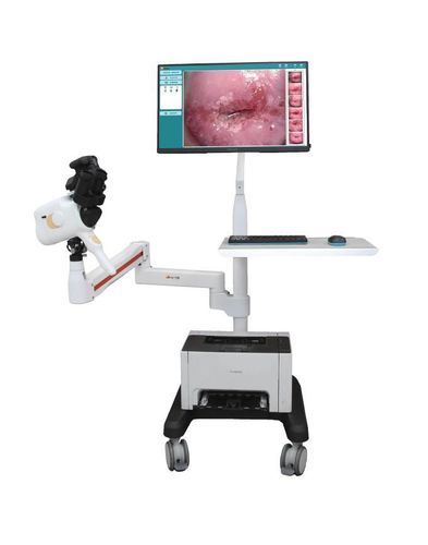 Digitaler Kolposkop - V1-V2 - Guangzhou Sunray Medical Equipment Co., Ltd. - Rollenstativ