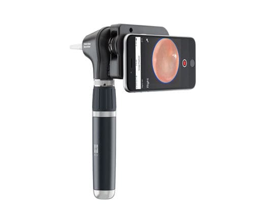 Otoskop für Erwachsene - MacroView® Plus - Welch Allyn - für Kinder / gerade / mit Spekulum