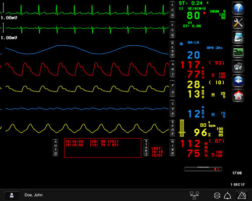Monitoring-Software - Spacelabs Healthcare - Mess / Alarm / Überwachung