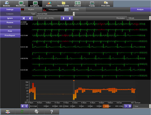 Visualisierungssoftware - Smart Disclosure - Spacelabs Healthcare - zur Stundensynchronisierung / Alarm / für EKG