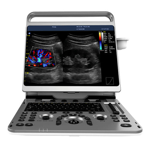 Tragbares Ultraschallgerät - Ebit 50 - CHISON Medical Technologies - für Multifunktions-Ultraschall / Farbdoppler / Schwarz-Weiß