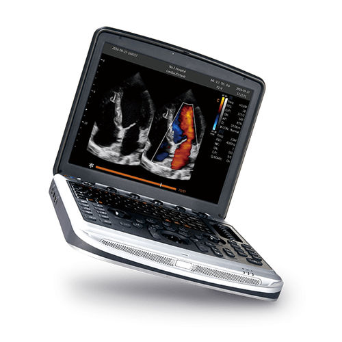 Tragbares Ultraschallgerät - SonoBook 8 - CHISON Medical Technologies - für Multifunktions-Ultraschall / Schwarz-Weiß / Farbdoppler
