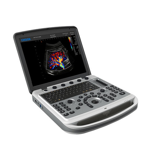 tragbares Tierärztliches Ultraschallsystem - CHISON Medical Technologies