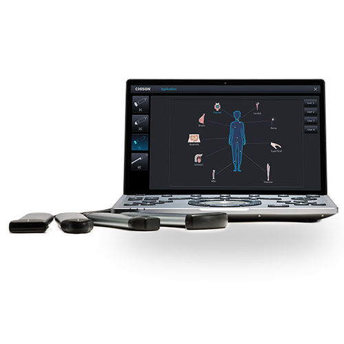 tragbares Ultraschallgerät - CHISON Medical Technologies
