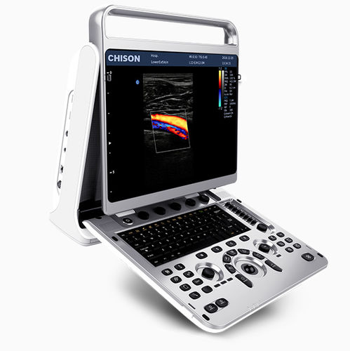 Tragbares Ultraschallgerät - EBit 20 - CHISON Medical Technologies - für Multifunktions-Ultraschall / für Ultraschalldiagnostik in Gynäkologie und Geburtshilfe / für bildgebende Ultraschalldiagnostik im Bauch- und Beckenbereich
