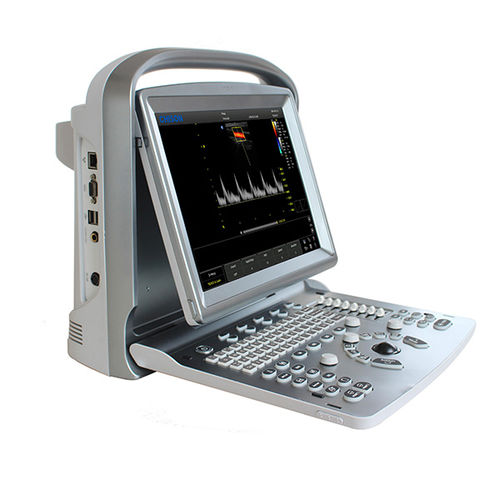 Tragbares Ultraschallgerät - ECO 5 - CHISON Medical Technologies - für Multifunktions-Ultraschall / Farbdoppler / Schwarz-Weiß