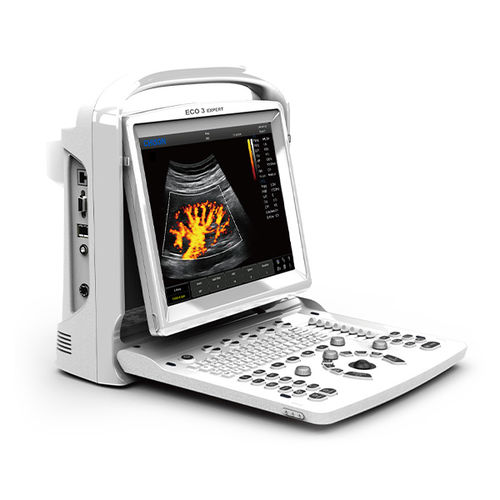 Tragbares Ultraschallgerät - ECO 3 Expert - CHISON Medical Technologies - für Ultraschalldiagnostik in Gynäkologie und Geburtshilfe / für bildgebende Ultraschalldiagnostik im Bauch- und Beckenbereich / für Kardiologie