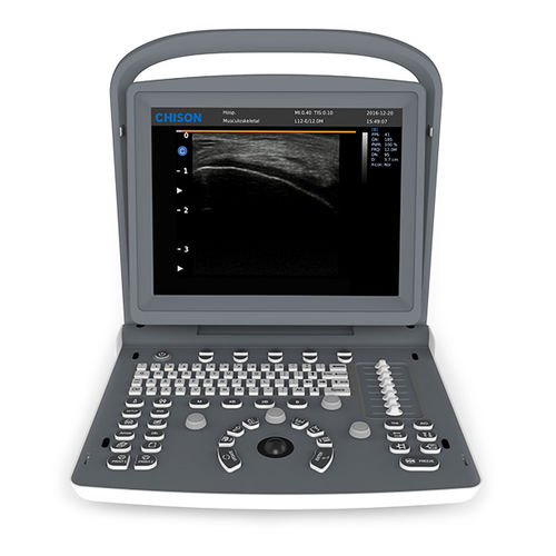 Tragbares Ultraschallgerät - ECO 2 - CHISON Medical Technologies - für Ultraschalluntersuchung von Muskeln und Skelett / Schwarz-Weiß / mit integrierter Konsole