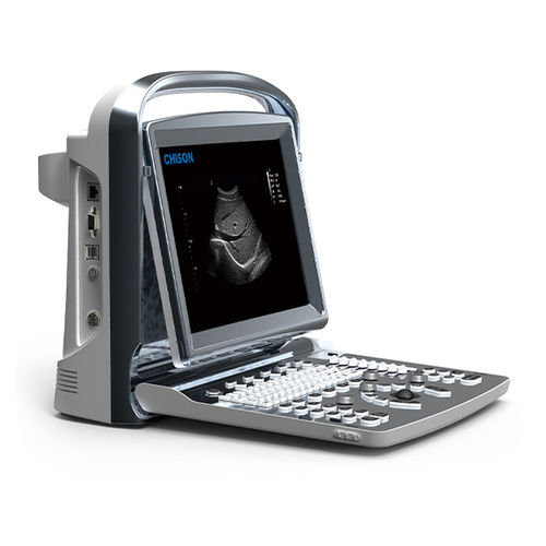 Tragbares Ultraschallgerät - ECO 1 - CHISON Medical Technologies - für Multifunktions-Ultraschall / Schwarz-Weiß / mit integrierter Konsole