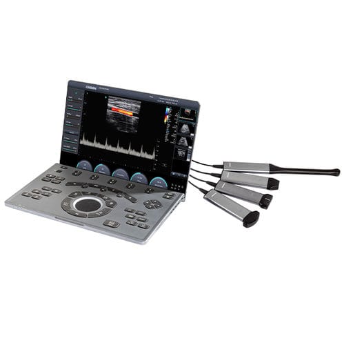 Tragbares Ultraschallgerät - SonoAir 30 - CHISON Medical Technologies - für Multifunktions-Ultraschall / für Ultraschalldiagnostik in Gynäkologie und Geburtshilfe / für Kardiologie