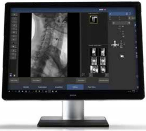 Medizinische Software - MUSICA™ - AGFA - Röntgen / Angiographie / Visualisierung