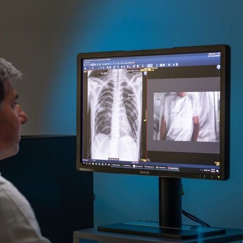 Software für Radiologie - SmartXR&trade; - AGFA - für PACS / für DCIM-Datei / Röntgen