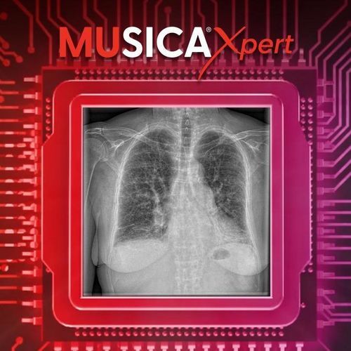 Medizinisches Nachbehandlungssystem - MUSICA Xpert™ - AGFA
