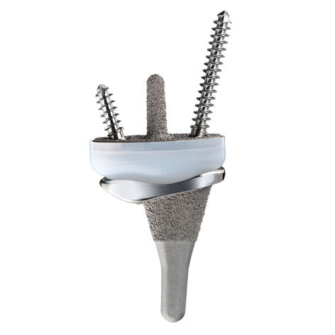 Zementierte Handgelenk-TEP - FREEDOM - Smith & Nephew