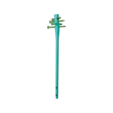 Marknagel / Humerus - TRIGEN™ - Smith & Nephew - mit proximaler Fixierung / mit distaler Fixierung / Metall