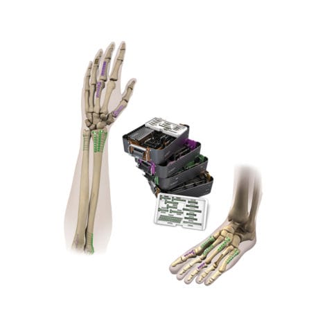 Kompressionsplatte für Hand - VLP™ MINI-MOD™ - Smith & Nephew - für Metatarsophalangealgelenk / für Handgelenk / für Knöchel