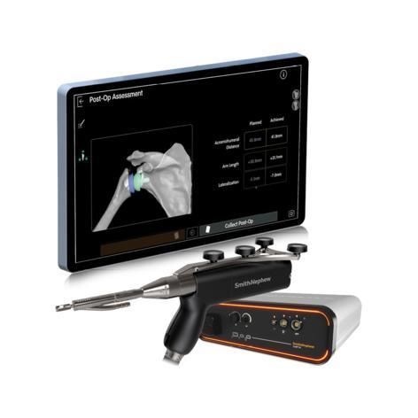 OP-Roboter / Schnitt - CORI - Smith & Nephew - Führung / Resektion / chirurgische Navigation