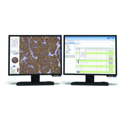 Automatischer Datendokumentationssystem - CaseCenter - Sysmex Europe