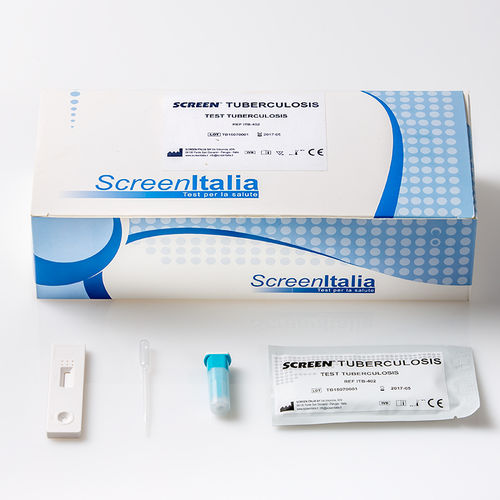 Tuberkulose-Schnelltest - SC-0739-40 - SCREEN ITALIA - für Qualitätskontrolle / A-Immunoglobuline / IgG