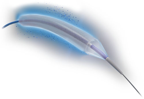 PTCA-Katheter - SELUTION SLR™  - Cordis - Koronar / Ballon / medikamentenbeschichtet