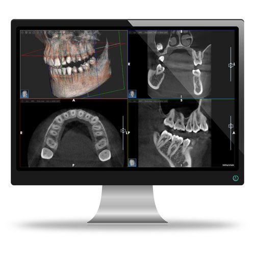 Dental-Software - AIS - ACTEON GROUP - für medizinische Bildgebung / für dentale Bildgebung / für Kliniken