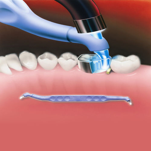 Dental-Polymerisierungsgerät - Trimax™ - AdDent, Inc.  