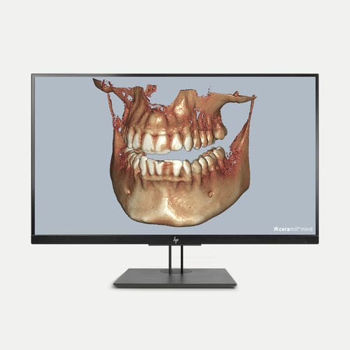 Software-Modul / DICOM-Visualisierung - Ceramill Dicom-Viewer - Amann Girrbach - Diagnose / Steuerung / CAD