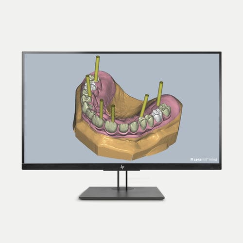 Software-Modul / CAD - Ceramill M-Gin - Amann Girrbach - für Dentalimplantologie