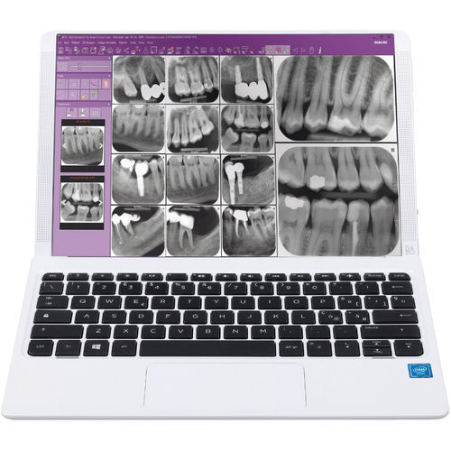 Software für dentale Bildgebung - iRYS - Anthos   - für DICOM / Steuerung / Viewer