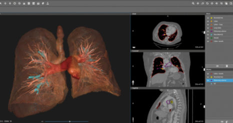 Visualisierungssoftware - D2P® - 3D Systems - Diagnose / Planung / CAD