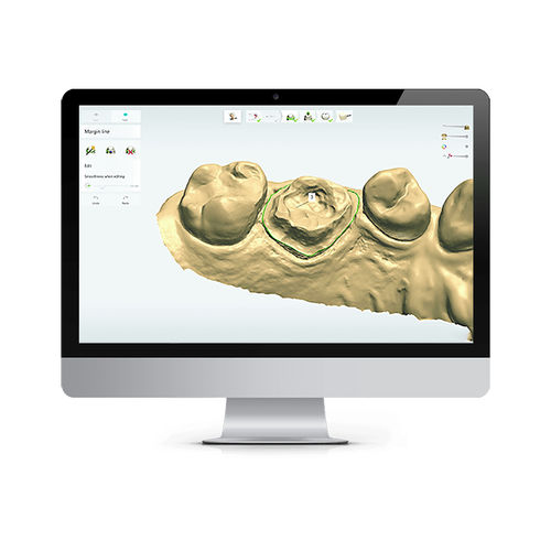 Dental-Software - TRIOS Design Studio - 3shape - Steuerung / Umform / Projektentwicklung