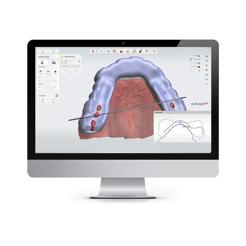 Steuerungssoftware - SPLINT STUDIO - 3shape - Dental / orthodontisch / Umform