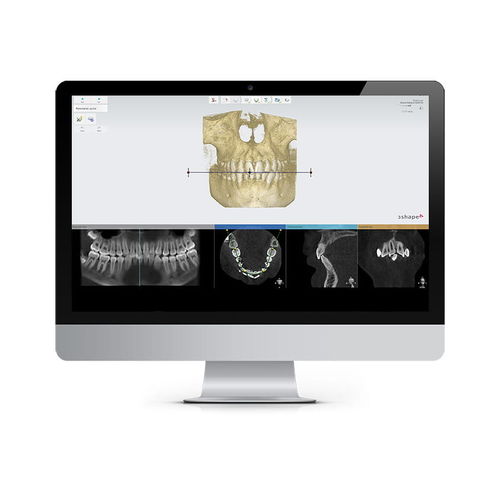 Behandlungsplanungssoftware - 3shape - Analyse / Aufzeichnung / Projektentwicklung